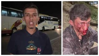 اعتداء شنيع على أحد الاطر التربوية لجمعية المواهب بالحوزية